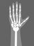 Human Arm Under X-rays Color Vector Illustration