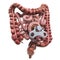 Human bowel with wind-up key. Treatment and recovery concept. 3D rendering