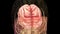Human brain or 4 lobes of brain and nervous impulse