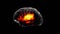 Human brain on black isolated background, glowing red pain. Concept of health and illness in stroke, stress, headache