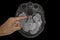 Human brain MRI, axial view