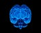 Human Brain X-Ray: Anatomy, Medicine and Science concept