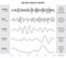 Human Brain Waves Diagram / Chart / Illustration