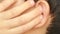 Human child ear close up. earache, otitis. Child touches a sore ear