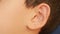 Human child ear close up. earache, otitis. Child touches a sore ear