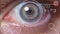 The human cybernetic eye