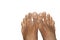 Human Dry Skin Feet In White Background