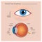 Human Eye Anatomy