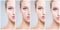 Human face in a collage. Young and healthy woman in plastic surgery, medicine, spa and face lifting concept.