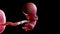 A human fetus week 11