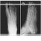 Human foot ankel and leg xray vector illustration. Top and right