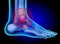Human foot. Leg skeleton. Joint inflammation.