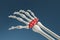 Human hand bones with pain in wrist, carpal tunnel syndrome