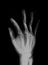 Human hand Xray Negative Scan