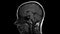 Human head brain MRI image footage. Side view profile. Health care and medicine