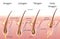 Human head hair growth cycle. Biological catagen, telogen phases. Hair infographics.