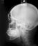 Human head x-ray film
