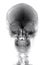 Human Head Xray Cutout