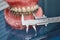 Human jaw or teeth model with metal wired dental braces