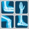 Human joints, knee and elbow, ankle wrist. Medical orthopedic vector set