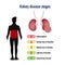 Human kidney health and disease poster