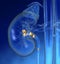 Human kidney with highlighted kidney stones, colorful medically 3D illustration