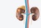 Human Kidney presents a medical concept as a organ that has the formation of painful minerals as a medical symbol with visual