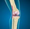 Human knee joint.