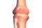 Human knee joints