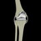 Human knee with knee replacement isolated 3d render image