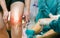 Human leg Osteoarthritis inflammation bone joints