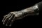 Human Limb Prosthetics, Enhancing Mobility and Empowering Lives