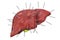 Human liver with acupuncture needles. Acupuncture treatment of liver concept, 3D rendering