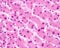 Human liver. Hepatocytes. Trinucleated hepatocyte