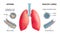 Human Lung Anatomy Infochart