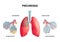 Human Lung Anatomy Infochart