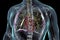 Human lungs affected by miliary tuberculosis, 3D illustration