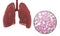 Human lungs anatomy and histology