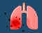 Human lungs infected by virus on blue background