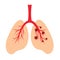 Human lungs, schematic illustration of human lungs infection with a virus. Anatomical structure of the human respiratory system.
