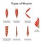 Human muscle types, realistic vector illustration, medicine