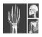 Human X-ray Image of Head, Hand and Shoulder Bone Vector Set