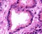 Human seminal vesicle. Epithelium