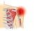 Human shoulder muscles and joints have a red signal.