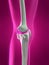 Human skeletal knee