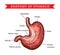 Human stomach anatomy, vector sketch medicine aid