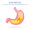 Human stomach. Gastroesophageal reflux disease. GERD, heartburn, gastric infographic. Acid moving up into the esophagus. Vector