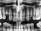 Human teeth xray in black and white