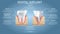 Human tooth and dental implant, vector educational poster