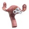Human uterus with wind-up key. Treatment and recovery concept. 3D rendering